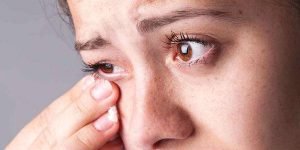 Leia mais sobre o artigo Com aumento de casos no verão, saiba como evitar a conjuntivite