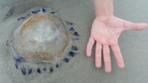 Leia mais sobre o artigo Verão em Florianópolis: como proceder em casos de queimaduras com água viva